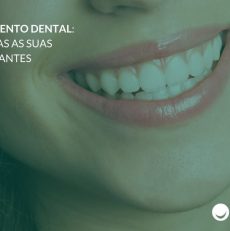 Clareamento dental: Tire dúvidas antes de fazer