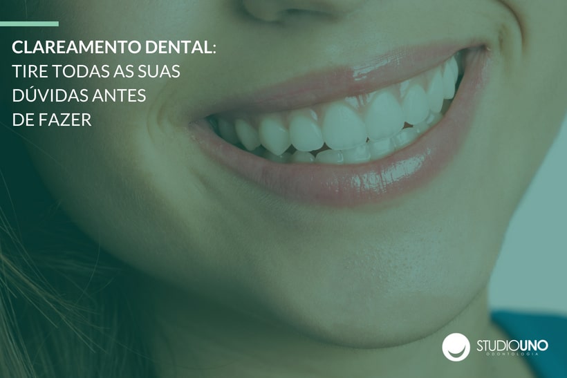 Clareamento dental: tire todas as suas dúvidas antes de fazer