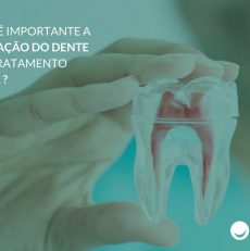 Por que é importante a restauração do dente após o tratamento de canal ?