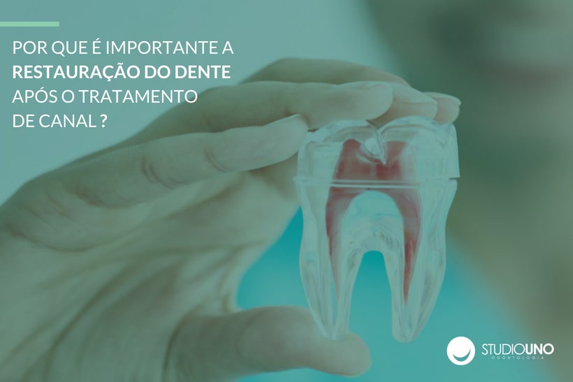 Importância da restauração do dente depois do tratamento de canal - Clínica StudioUno Odontologia - Brasília/DF