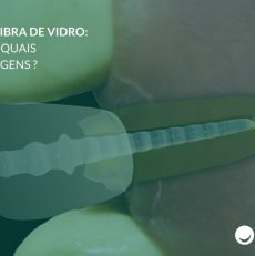 Pino de fibra de vidro: o que é e quais as vantagens?