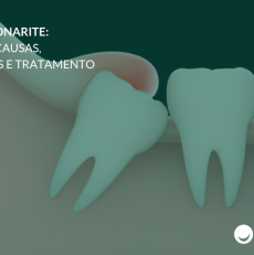 Pericoronarite: o que é, causas, sintomas e tratamento