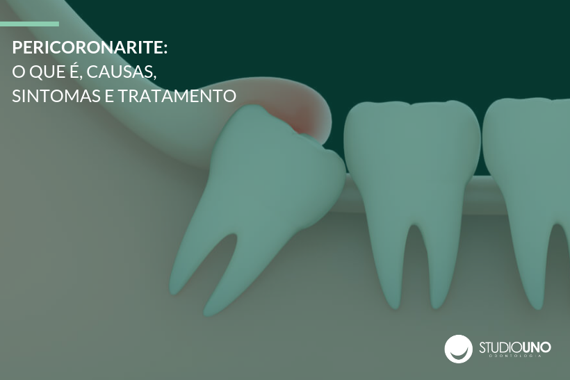 Pericoronarite: saiba o que é, quais as causas, os sintomas e qual o tratamento