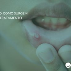 Aftas: o que são, como surgem e qual o tratamento