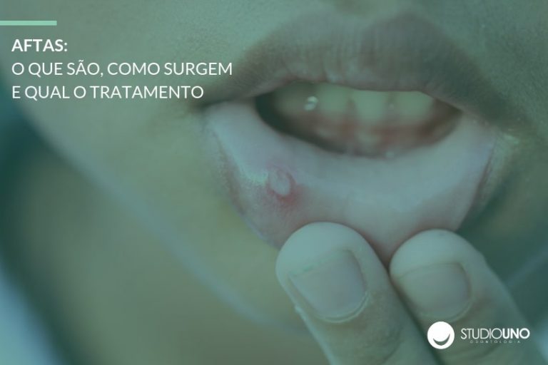 Aftas: o que são, como surgem e qual o tratamento - StudioUno Odontologia