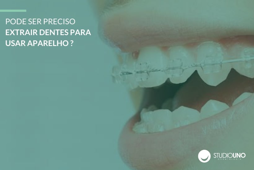 Extração de dente no tratamento ortodôntico - StudioUno Odontologia - Brasília/DF