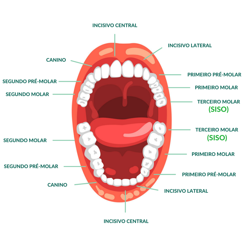 Dentes Siso na Arcada Dentária - Clínica Odontológica StudioUno - Brasília-DF