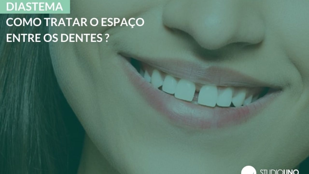 várias bocas em posições diferentes. com dentes, língua, sorriso