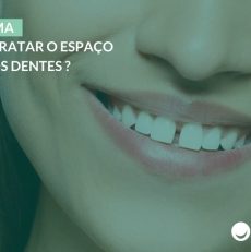 Diastema: como tratar o espaço entre os dentes?