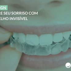 Invisalign em Brasília: melhore seu sorriso com o aparelho