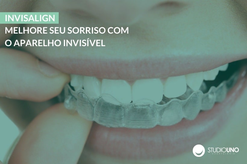 Invisalign: Melhore seu sorriso com o aparelho invisível - StudioUno Odontologia - Brasília/DF