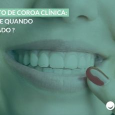 Aumento de coroa clínica: o que é e quando é indicado?