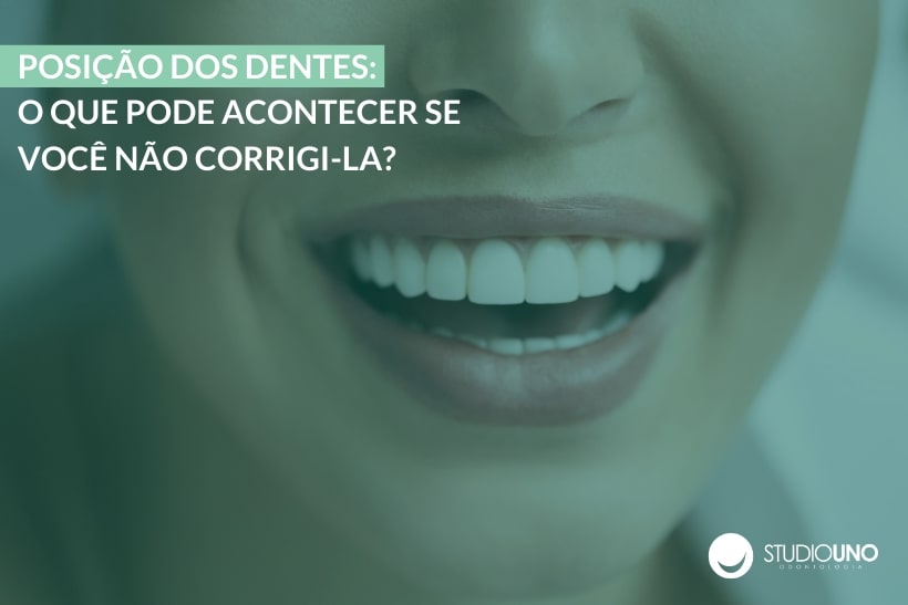 Corrigir a posição dos dentes | StudioUno Odontologia Brasília DF