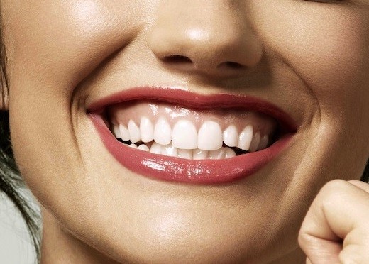 Correção do sorriso gengival com aumento de coroa clínica | StudioUno Odontologia Brasília DF