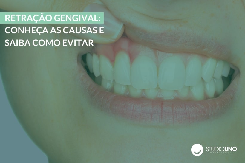 Retração gengival: Causas e como Evitar e Tratar | StudioUno Odontologia Brasília DF