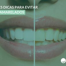 4 simples dicas para evitar dentes amarelos