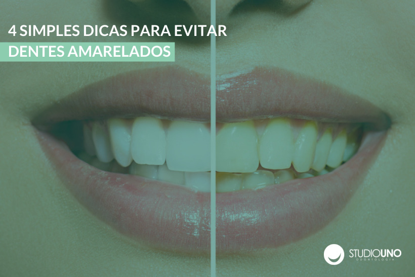 Dentes amarelados: 4 dicas para evitar o problema - StudioUno Odontologia Brasília DF