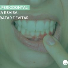 Doença periodontal: conheça e saiba como tratar e evitar